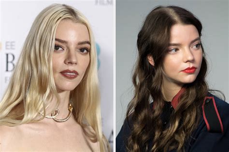 anya taylor joy eye condition